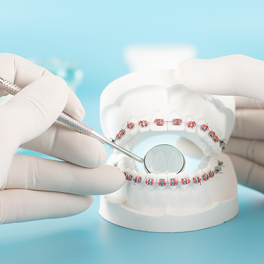 矯正器具のセット